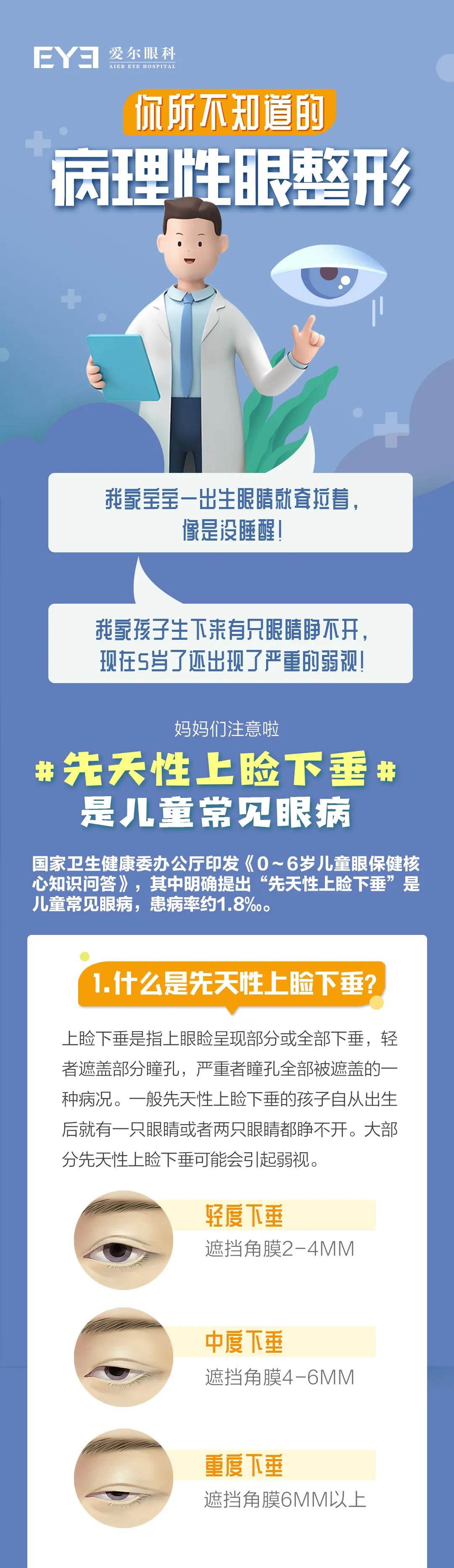 先天性上睑下垂是儿童常见眼病插图(1)