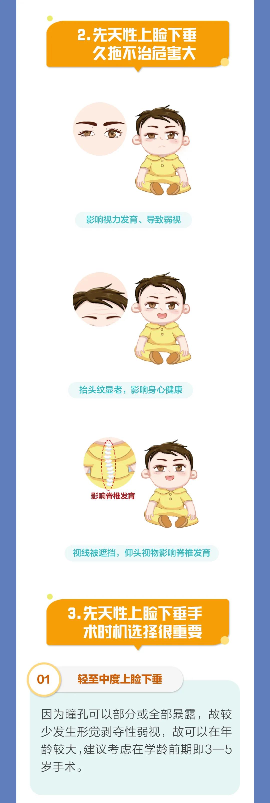 先天性上睑下垂是儿童常见眼病插图(2)