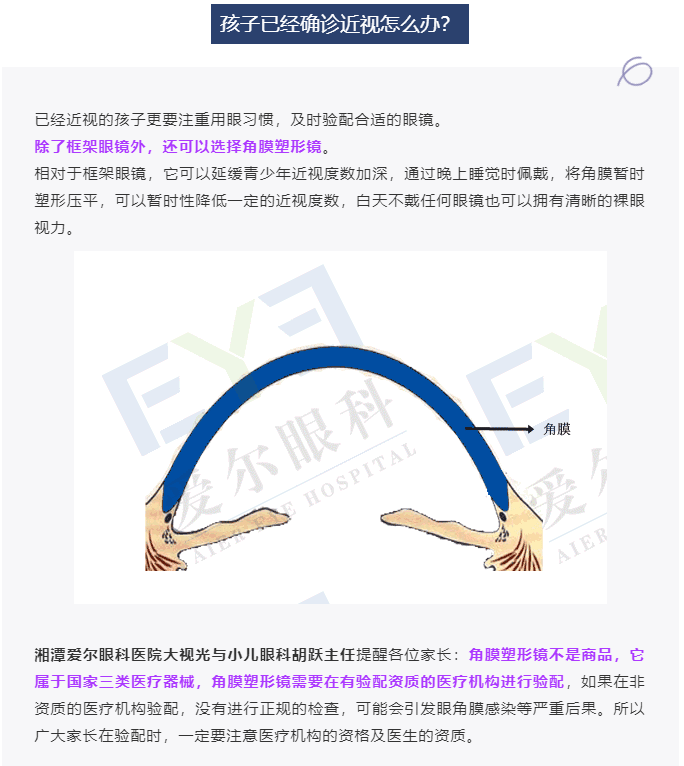 开学视力不掉队，这份开学眼健康指南请收藏插图(5)
