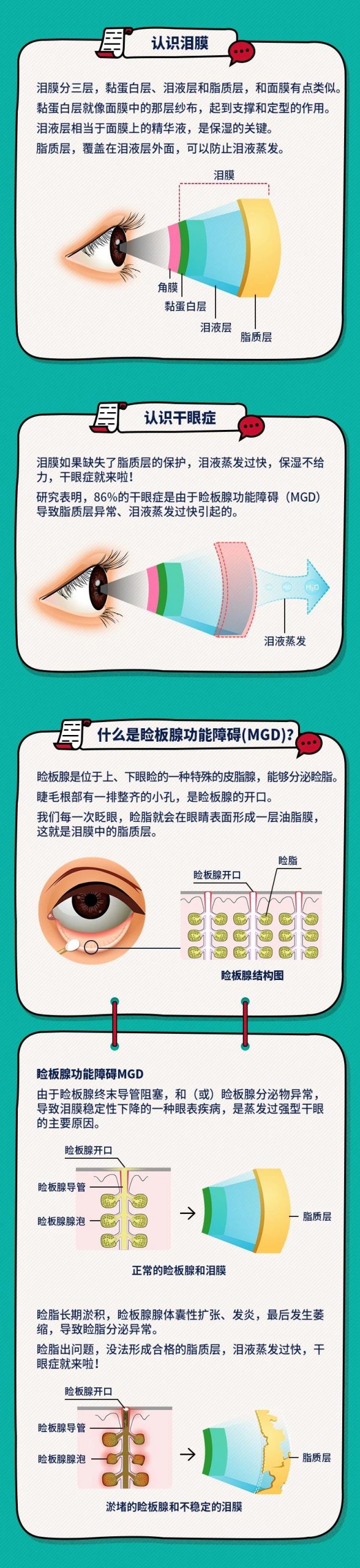 热敷、按摩一次性搞定!种草干眼治疗黑科技——LipiFlow!