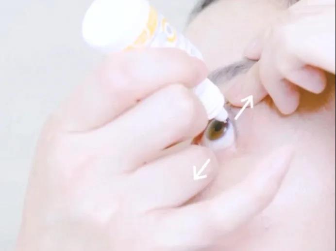 帮帮我，我的角膜塑形镜片怎么取不下来？