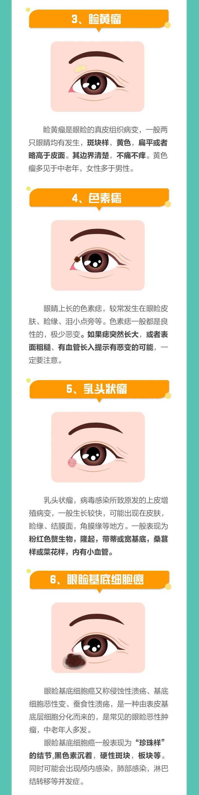 眼睛长了个“疙瘩”，不会是肿瘤吧？！插图(1)