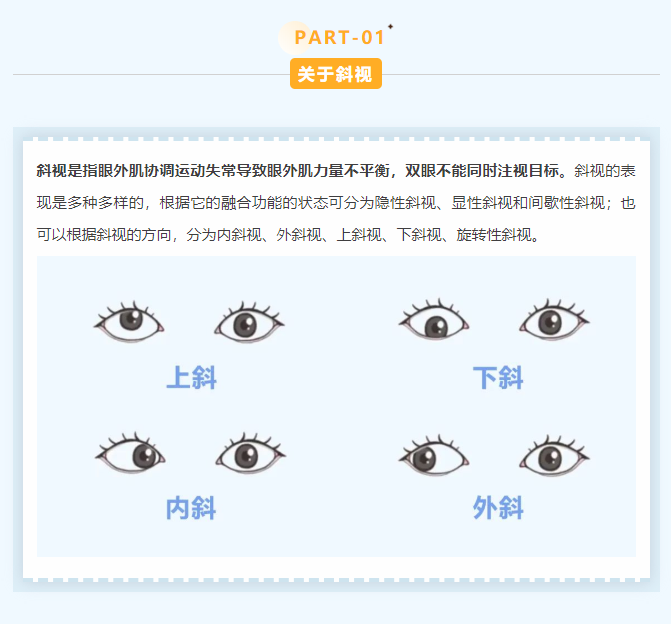 歪头斜眼是大问题！孩子斜视，一定要尽早治疗！插图(2)