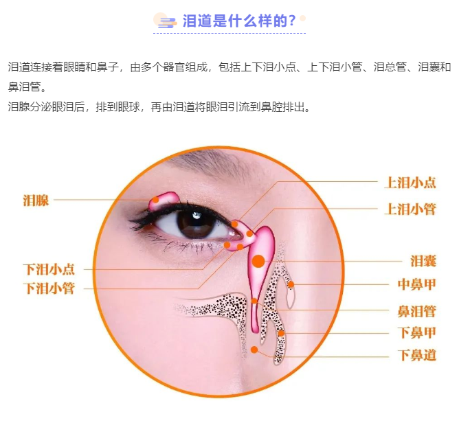 所有“哭”都与泪道有关吗？插图(2)