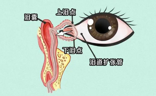 眼病也有“性别歧视”？女性应谨防这几种眼病插图(2)