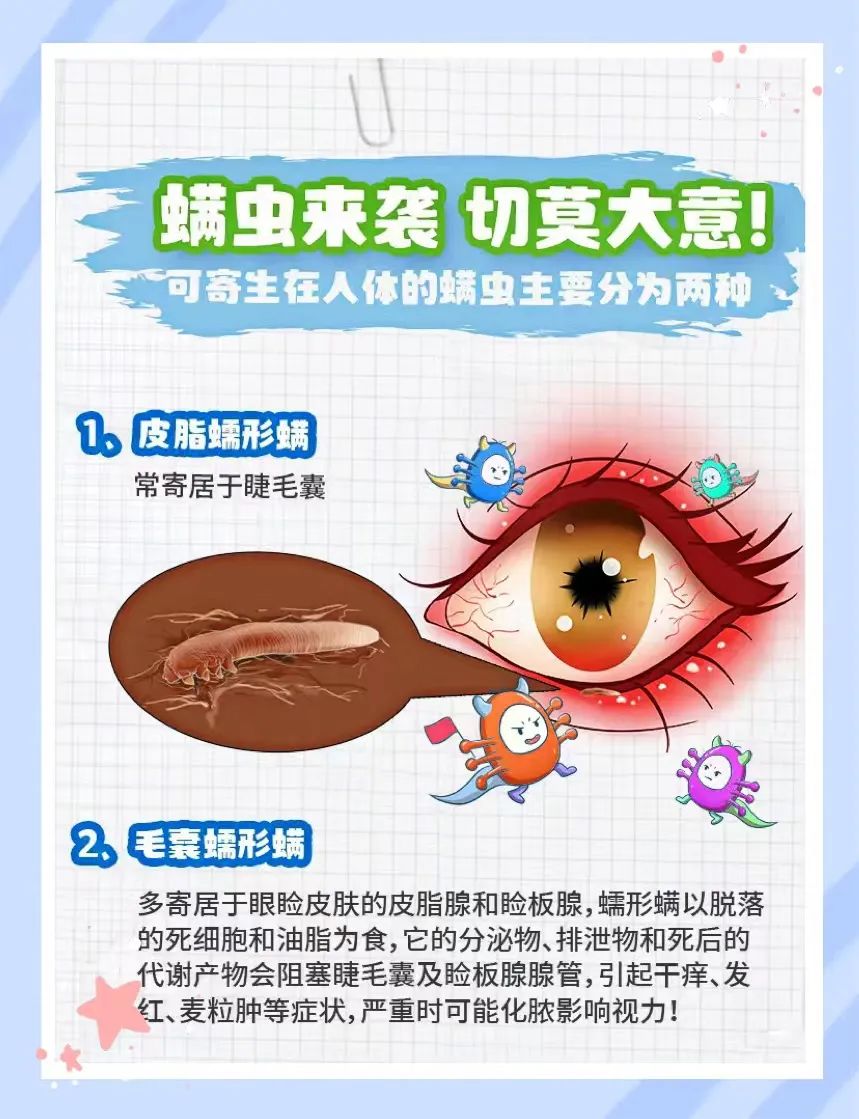 OMG！螨虫还会跑进眼睛？插图