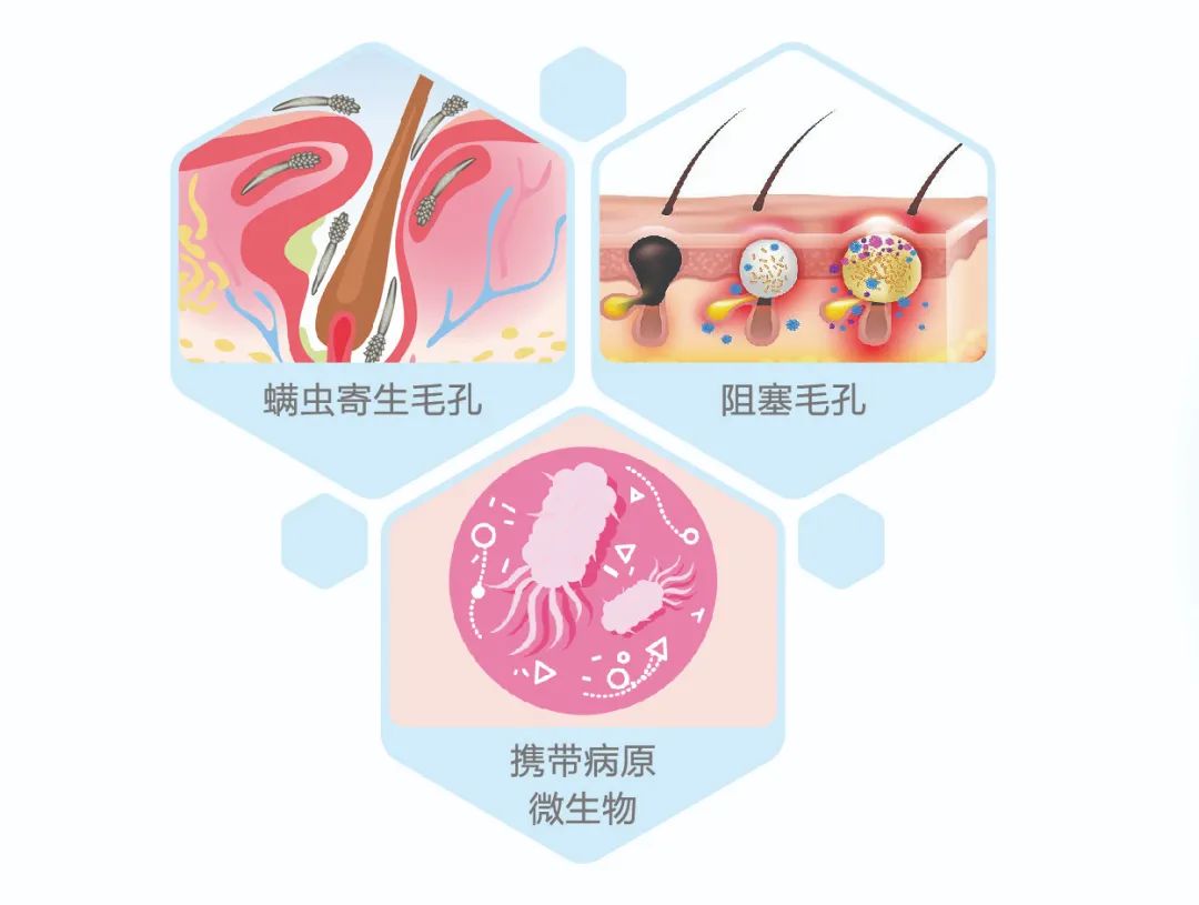 眼睛里有虫子？要做好这4点插图(1)