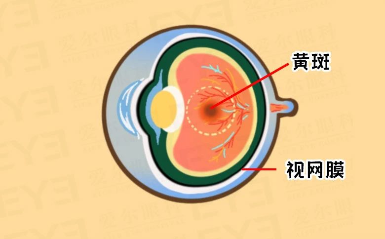 一张方格表，可测眼底黄斑健康？插图(2)