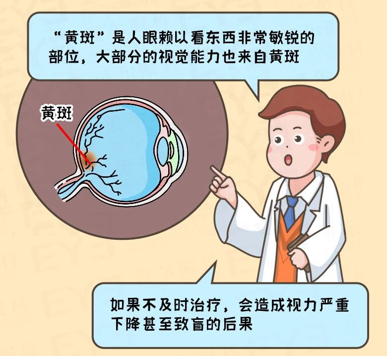 一张方格表，可测眼底黄斑健康？插图(3)