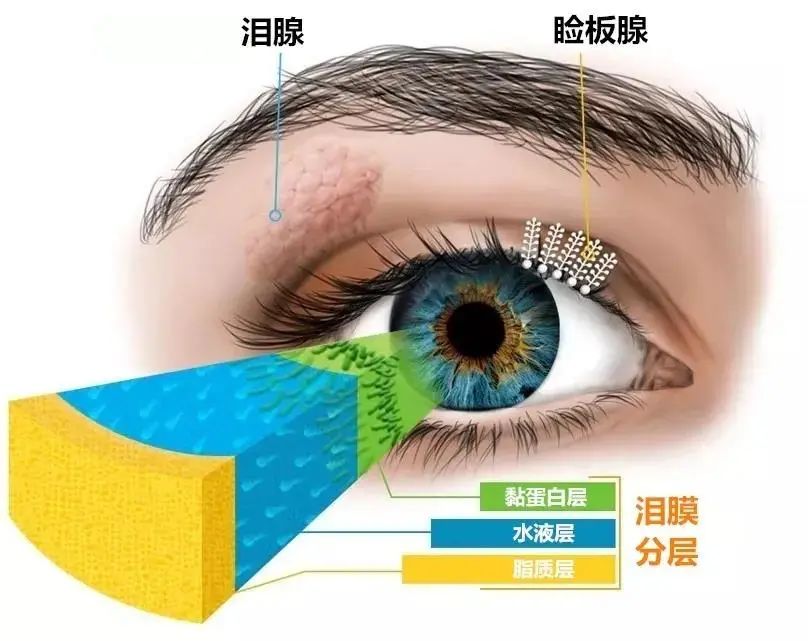 眼睛干到发出求救信号，快注意！插图