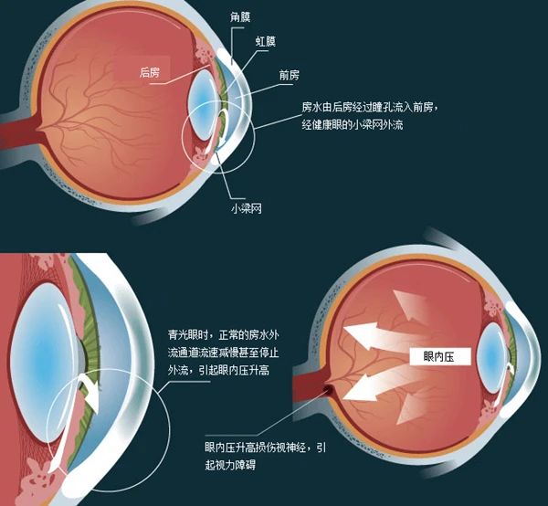 关灯后玩手机诱发致盲眼病，这可不是危言耸听插图(1)