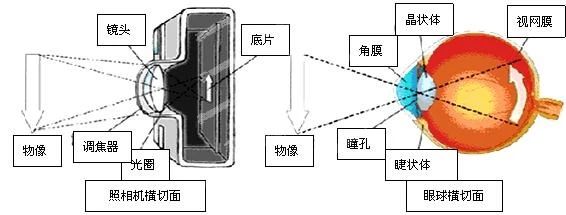 爱尔科普|带你揭开“眼底病”的神秘面纱~插图