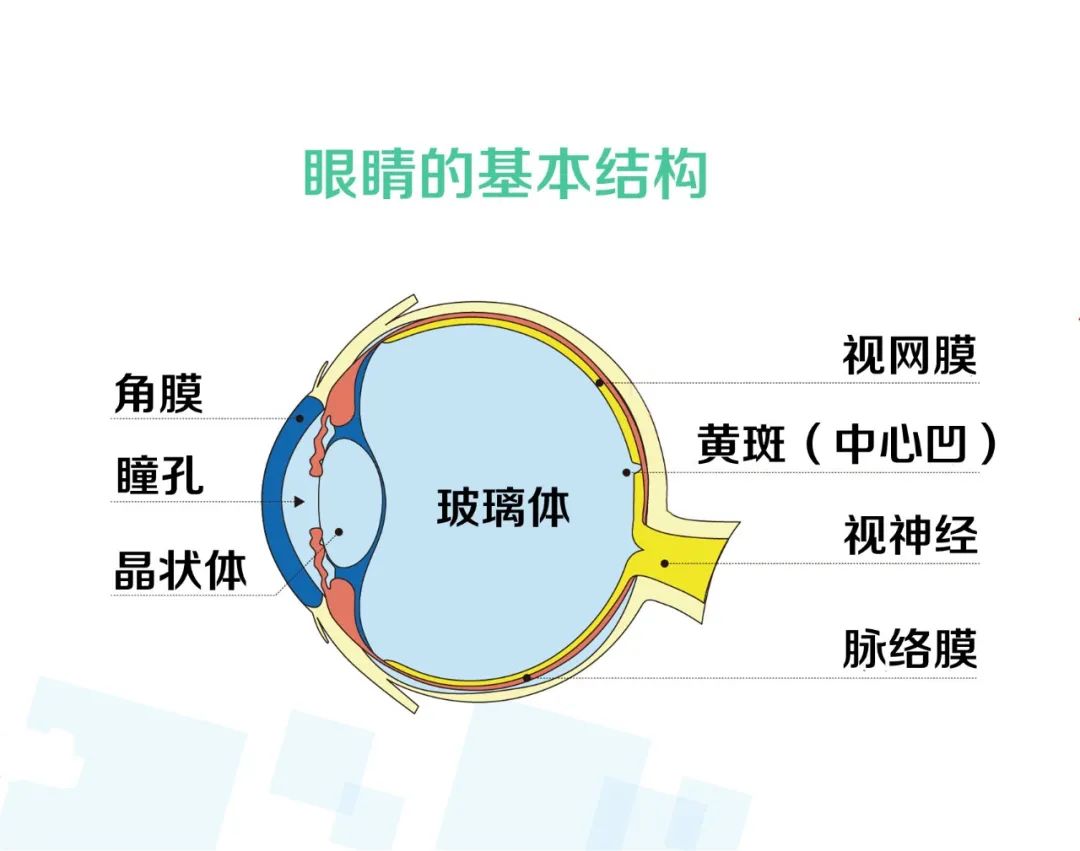 为什么近视手术前要停戴隐形眼镜?插图