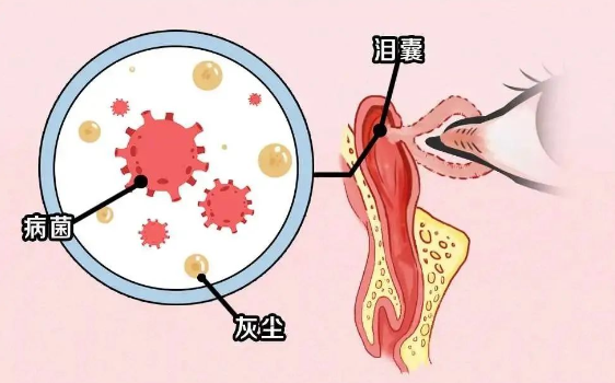 别大意！眼屎增多，要警惕……插图(1)