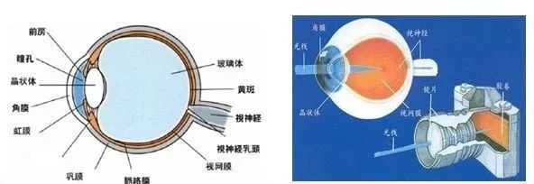 屈光不正，就是近视眼吗？插图