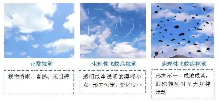 抓不到又赶不走的“蚊子”，到底有多烦人？插图(1)