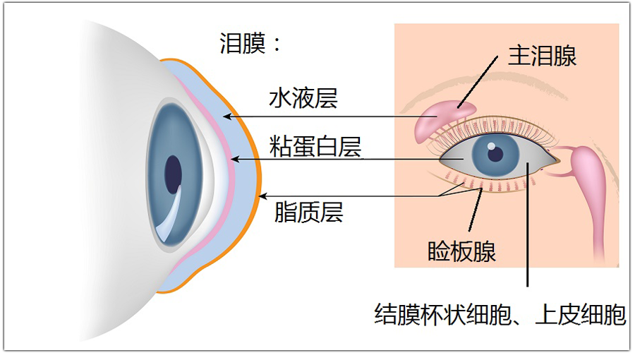 干眼症，并不只是眼睛干涩这么简单！插图