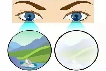 单眼近视和双眼近视哪种危害更大？插图