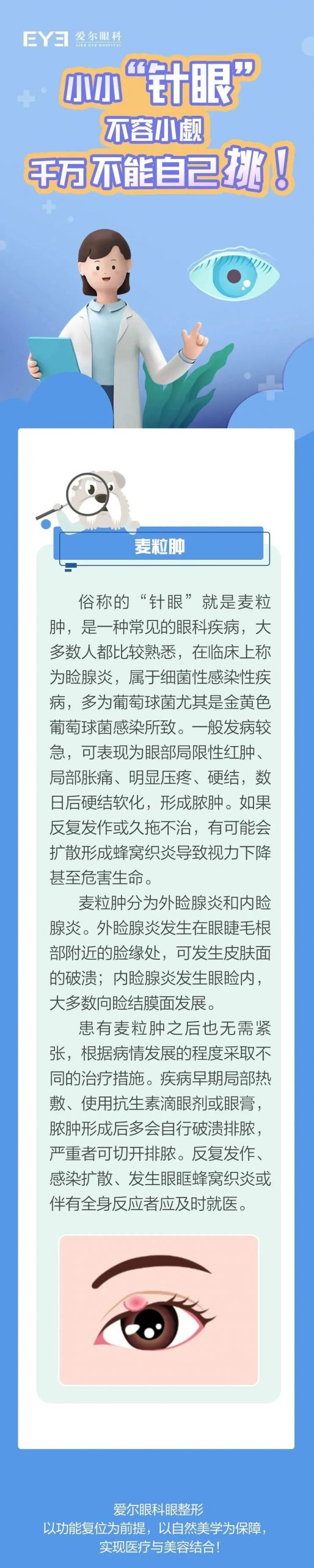 眼科专家说，“针眼”真的不能自己挑！插图
