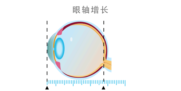 定期的眼底检查，该怎么查？什么人群需注意？插图(1)