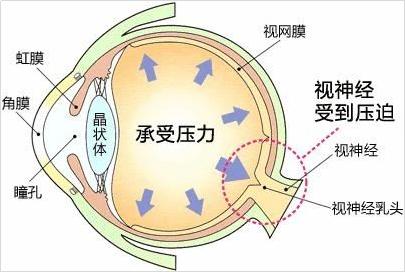 定期的眼底检查，该怎么查？什么人群需注意？插图(2)