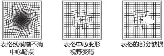 定期的眼底检查，该怎么查？什么人群需注意？插图(8)