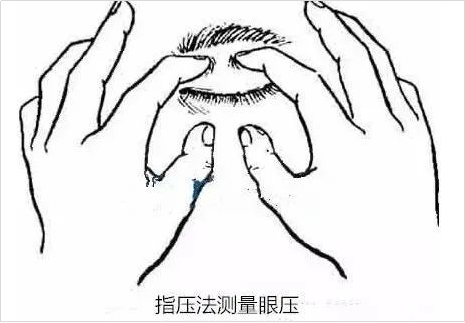 定期的眼底检查，该怎么查？什么人群需注意？插图(9)