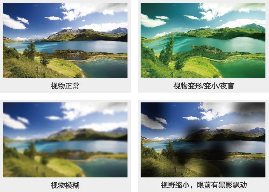 糖尿病眼病，不容忽视的“视力杀手”！插图(2)