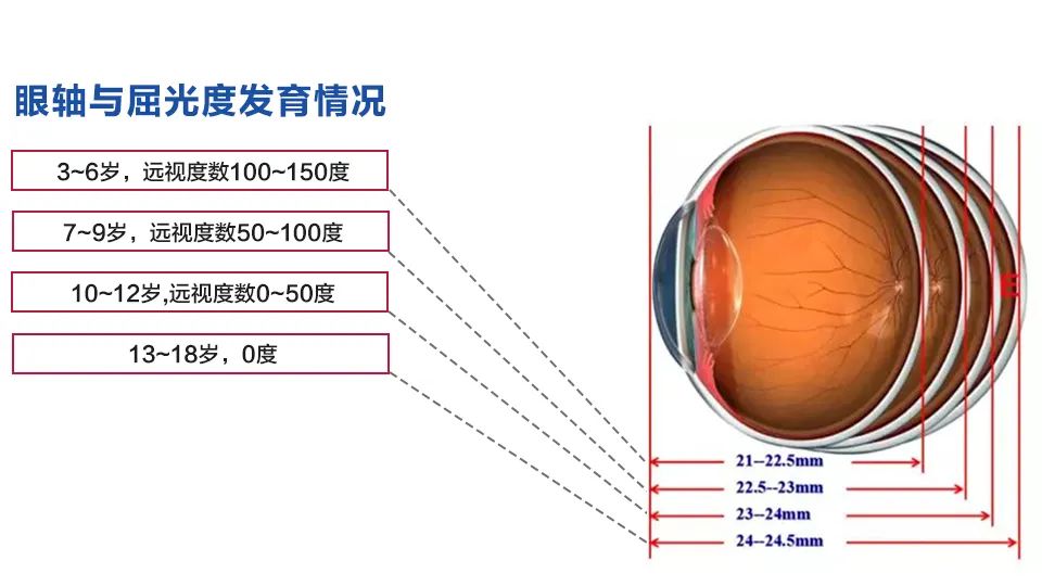 6条近视防控误区，你中招过几条？插图