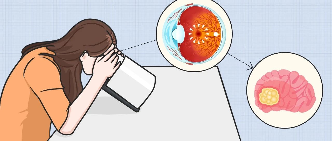 眼底检查到底有多重要？插图