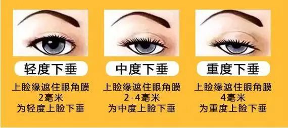 孩子看起来总是“睡不醒”？要警惕这种病！插图