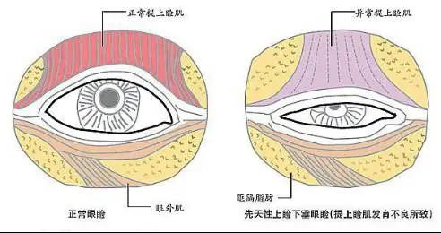 孩子看起来总是“睡不醒”？要警惕这种病！插图(1)