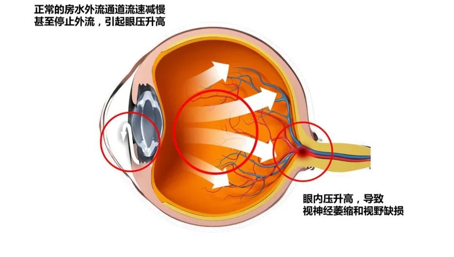 关灯玩手机，真的会伤害眼睛吗？插图