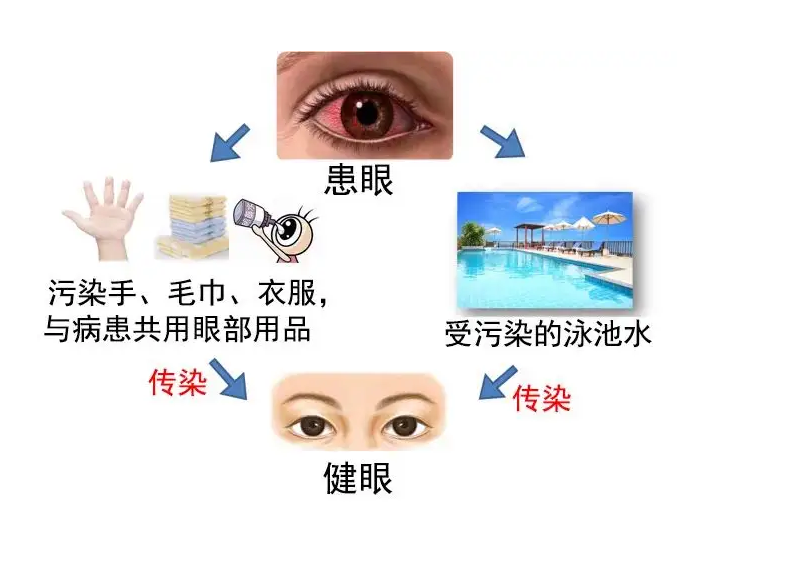 三伏天「晒背」养生火了，眼睛养护也很重要！插图(2)