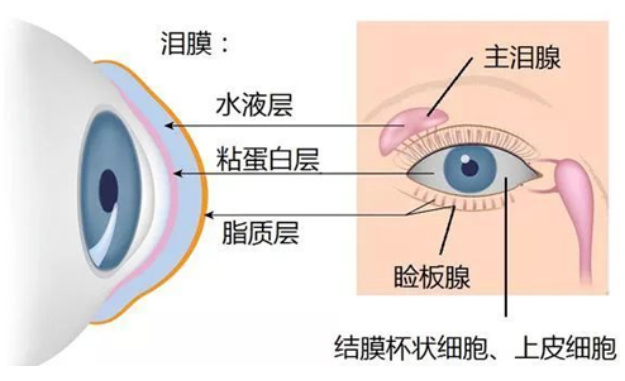 干眼患者必备指南插图