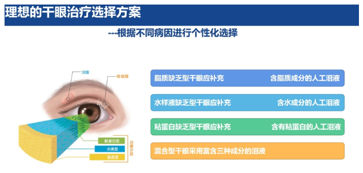 干眼患者必备指南插图(1)