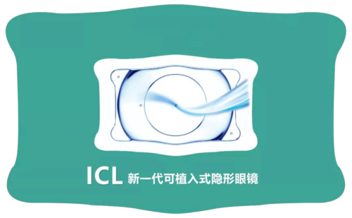 近视手术的“天花板”ICL晶体植入全攻略，看这一篇就够了~插图