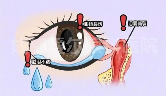 无法自控地流泪，泪道可能已经受伤了！插图(1)