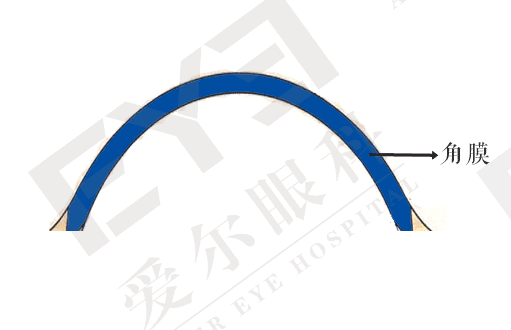 角膜塑形镜只能戴到18岁？插图(3)