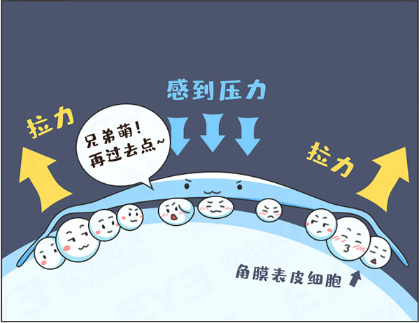 角膜塑形镜只能戴到18岁？插图(4)