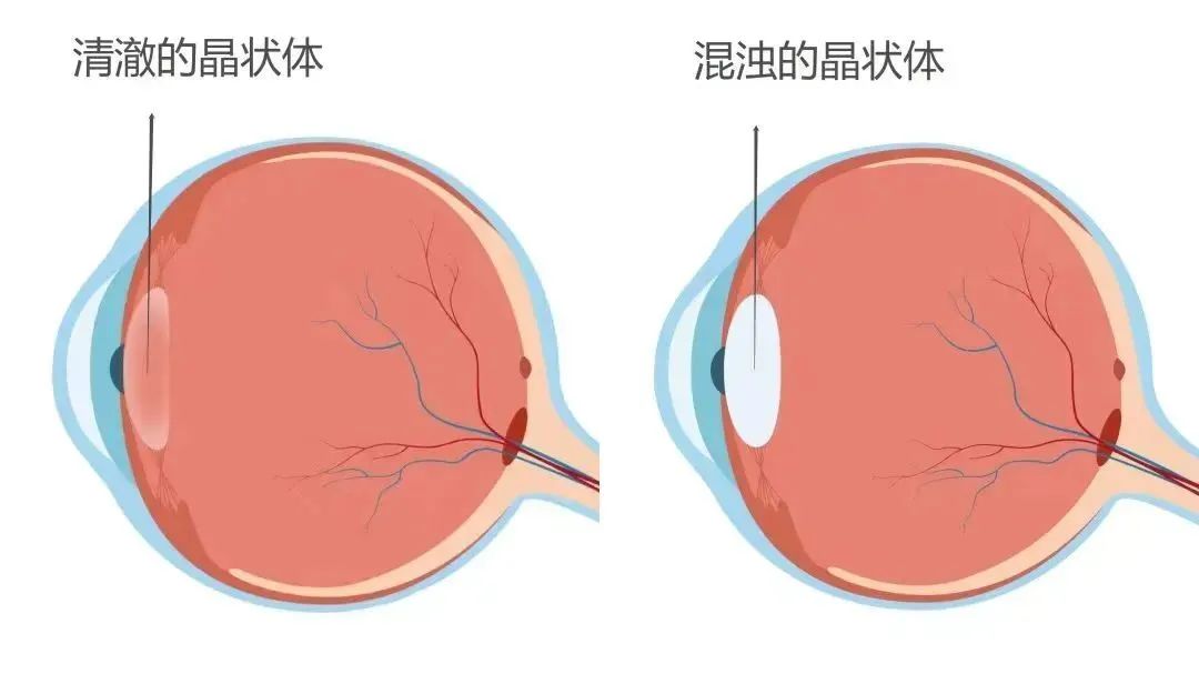 听说，这种病人人都会得？插图