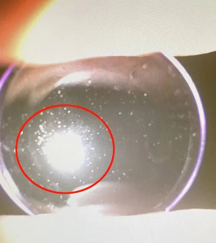 配了OK镜就一劳永逸？这个错误家长不能犯插图(4)