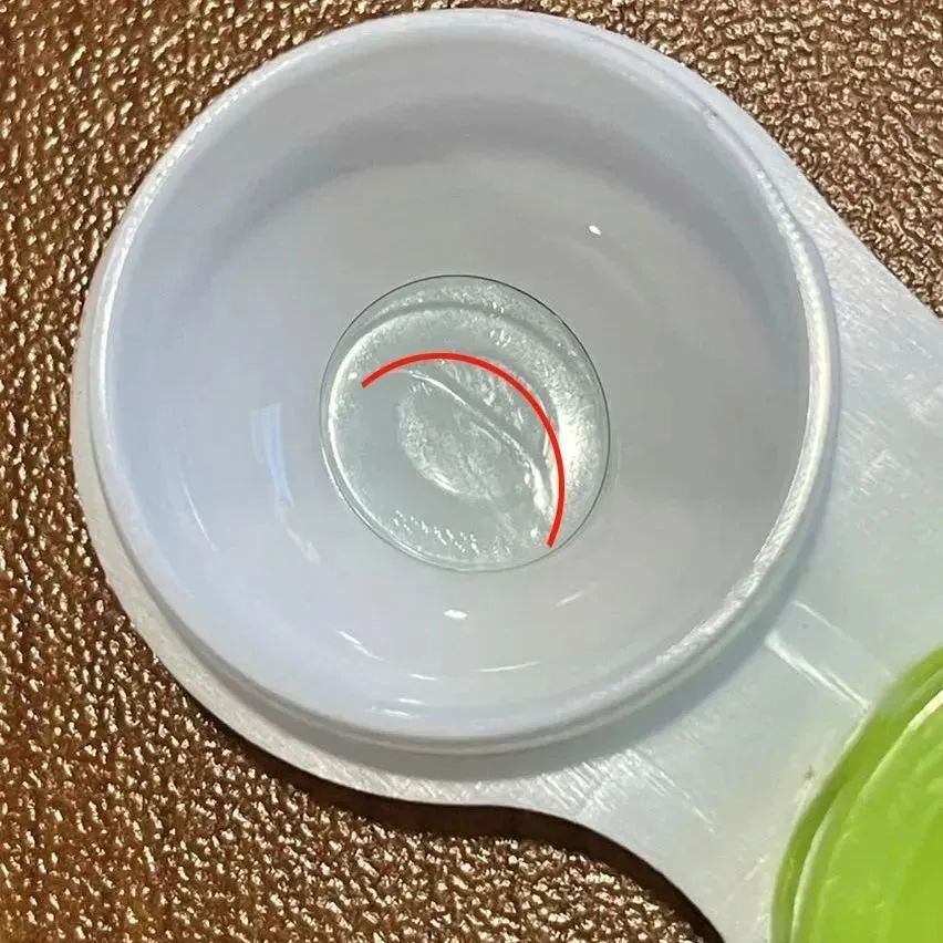 配了OK镜就一劳永逸？这个错误家长不能犯插图(5)