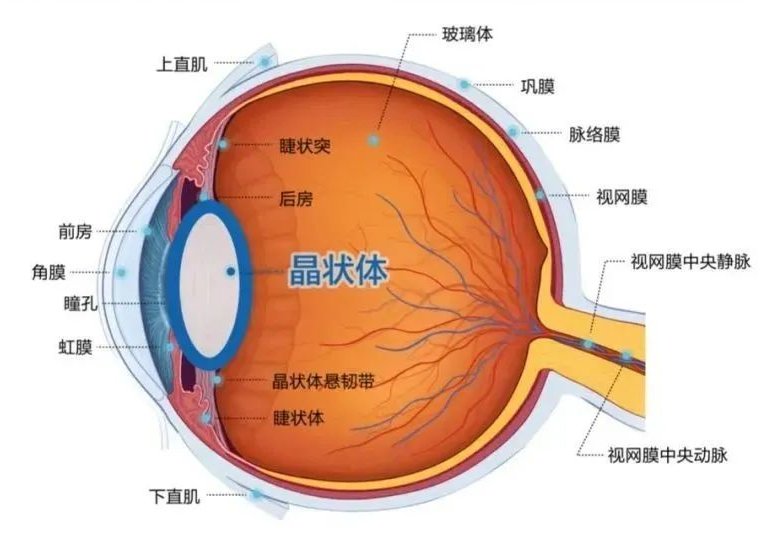 儿童也会患白内障 ？这些你必须知道！插图