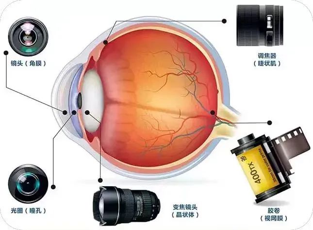 眼底是眼睛的“晴雨表”，重视眼底检查！插图(1)
