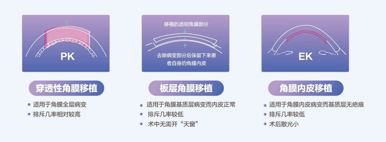 什么是角膜盲症？角膜难求怎么办？插图(1)