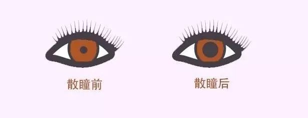 近视手术想做就能做？先看看术前攻略！插图