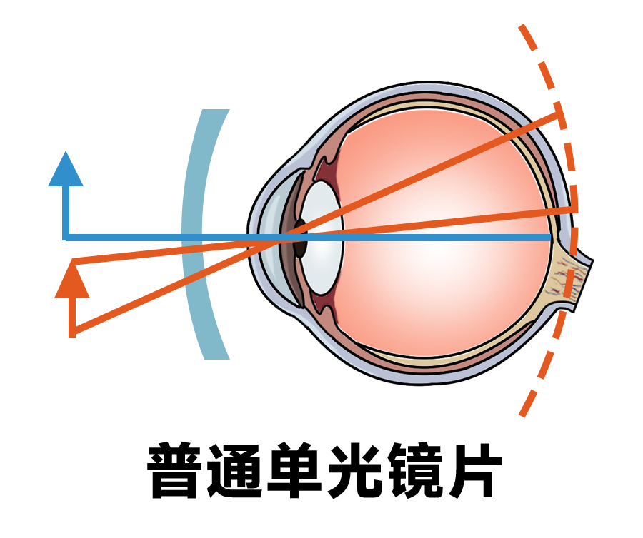 开学护眼第一课！这些近视防控tips用起来！插图(1)