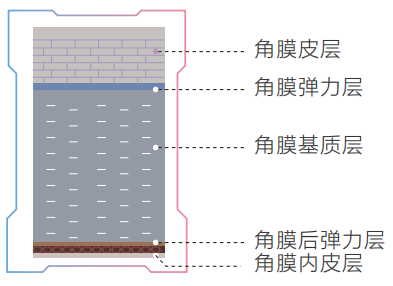 角膜薄到底是什么概念？插图(1)