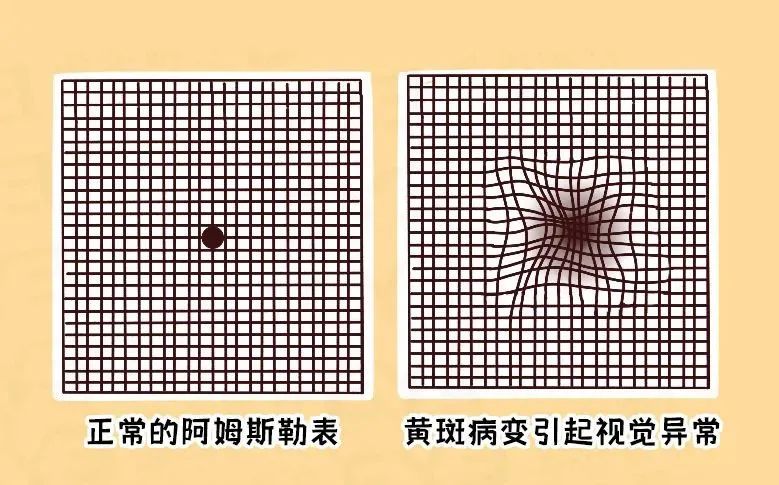 新知识Get√ 许多全身疾病都可以通过眼底反映出来插图(5)